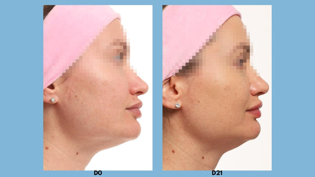 Sequência de fotos de perfil do rosto: renovação e viço