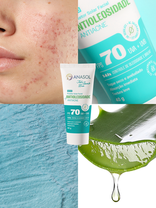 Colagem com pele com acne, aloe vera e o protetor solar Anasol Todo Santo Dia Antiacne FPS 70