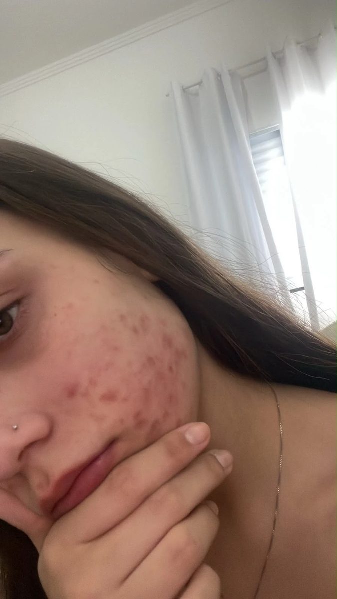 Antes